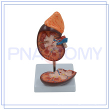 PNT-0561-1 Promotional Human Kidney Section with Renal Nephron and Corpuscle Enlarged of China